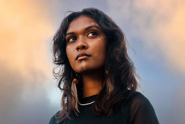 Portrait of a woman with vitiligo and wavy dark hair against a soft, ethereal background.